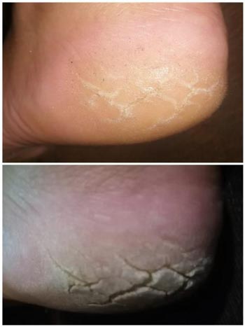 affieplaas foot pamper illustrate affieplaas foot pamper illustrate